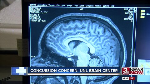 Concussion Concern: UNL Brain Center Debrief
