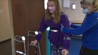 Step by step: Medina County teen paralyzed by virus determined to walk again