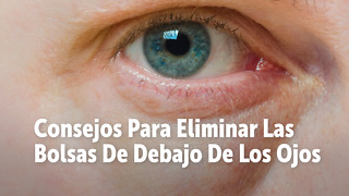 Consejos Para Eliminar Las Bolsas De Debajo De Los Ojos