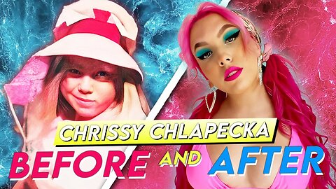 Chrissy Chlapecka | Before & After | Plastic Surgery Transformation