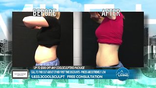 Hollywood Body Laser Center- Coolsculpting Package