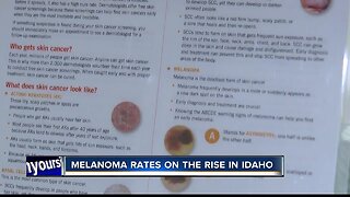 Melanoma rates on the rise in Idaho