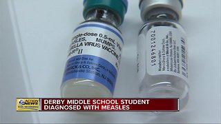 Birmingham student diagnosed with measles
