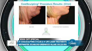 Coolsculpting & Lipo Laser // MD Body & Med Spa