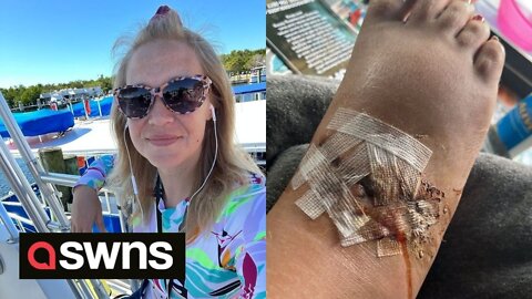 Swimmer films herself moments after she was bitten on her foot by SHARK in Florida