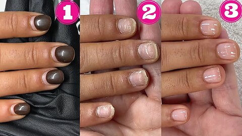 Acrylic to natural nails. The full process | Gentle acrylic + gel removal, manicure and CND Shellac