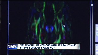 North Buffalo stroke survivor speaks out