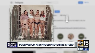 Gilbert moms go viral with postpartum picture