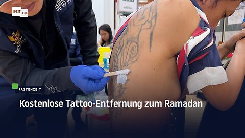 Kostenlose Tattooentfernung für Muslime an Ramadan