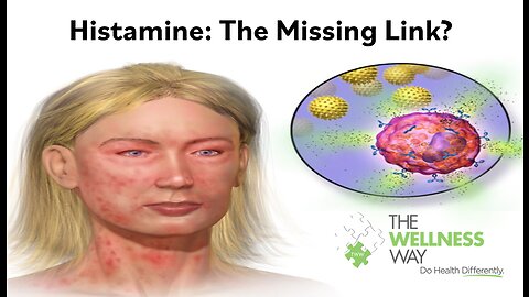 Histamines: The Missing Link?