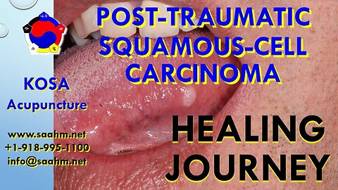 Post-Traumatic Squamous-Cell Carcinoma Testimonial