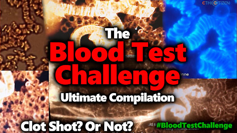 BLOOD TEST CHALLENGE:Blood Testing & The Vaccine, Is There Clotting? #ClotShot #BloodTestChallenge