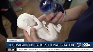 Doctors develop tech that helps fetuses with spina bifida