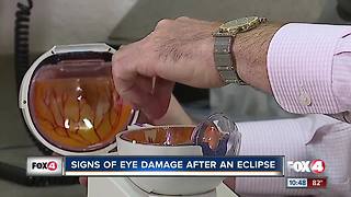 Signs of eye damage after an eclipse