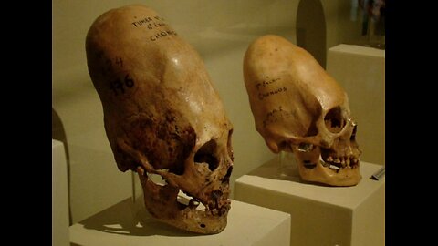 Elongated Skulls