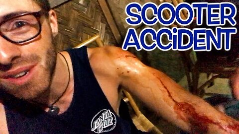 SCOOTER ACCIDENT IN THE PHILIPPINES (I LOVE FILIPINO PEOPLE)