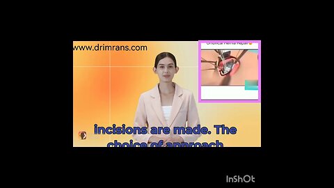 Umbilical Hernia surgery Animation
