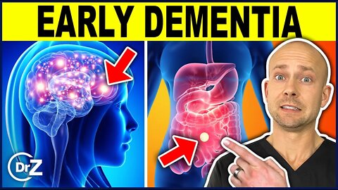 10 Warning Signs You Have Dementia