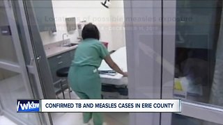Confirmed TB and measles cases in Erie County
