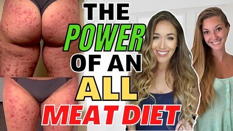 MEAT ONLY Carnivore Diet & 75 Hard Challenge RESULTS! (Psoriasis & Binge Eating ft Dr. Jen Geissert)