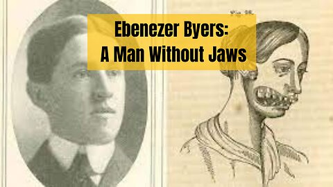 Eben Byers, Man who Drink Radioactive as medicine till his Jaw fell off