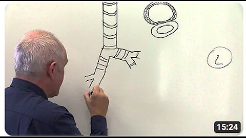 Respiratory System 1, Lungs, chest wall and diaphragm