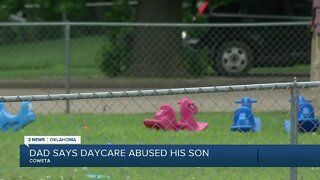 Dad Says Daycare Abused His Son