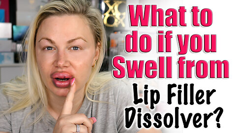 What to do if you SWELL from Lip Filler Dissolver! AceCosm | Code Jessica10 saves you Money