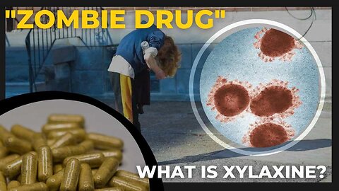 Xylazine the dangerous veterinary drug causing a zombie-like state in some humans | Zombie Drug |
