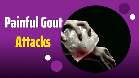 Painful Gout Attacks [gout treatment for pain] #shorts