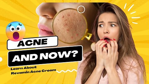 What is the Phenomenon of Revamin Acne Cream? Revamin Acne Cream