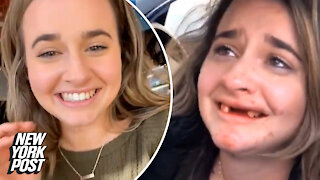 Woman loses front teeth after drinking mimosas in viral video