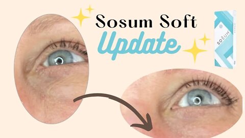 Sosum Soft Update Day 3 until Day 5
