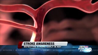 Stroke awareness: key getting to the hospital on time