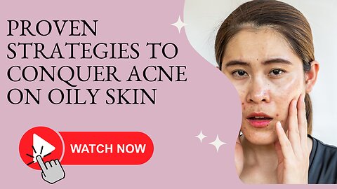 Say Goodbye to Oily Skin Woes: Proven Tips for Radiant, Acne-Free Skin!"
