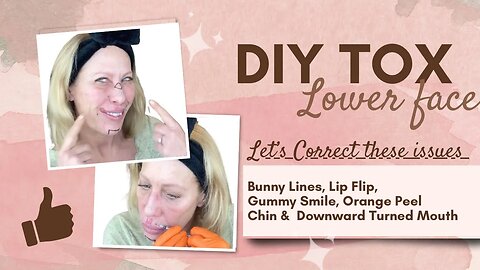 DIY Tox for Bunny Lines, Gummy Smile, Lip Flip, DAO’s and Orange Peel Chin
