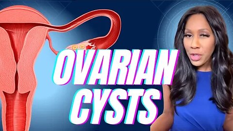 What Are Ovarian Cysts? What Are the Symptoms? How Are Ovarian Cysts Treated? A Doctor Explains