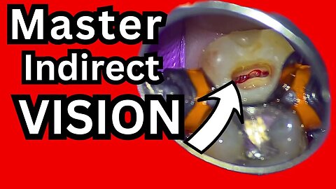 Master Indirect Vision - One of the Hardest Beginner Dental Skills