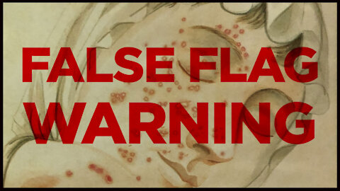 WARNING! Timeline Shows Threat of Incoming Smallpox False Flag