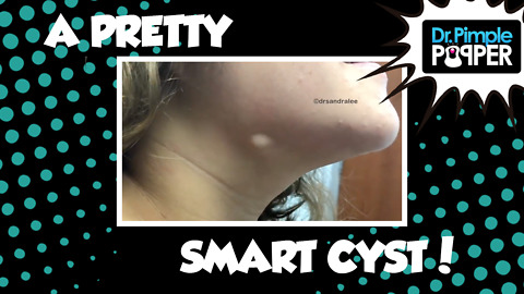 A Pretty Smart Cyst!