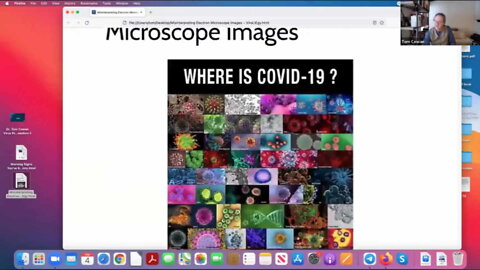Do the Pictures on the Electron Microscope Prove That SARS-COV-2 Exists - Dr. Tom Cowan - 2022-02-04