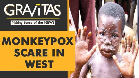 Monkeypox cases spread in North America, Europe