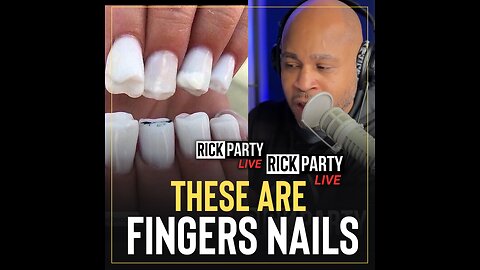 These are fingernails?