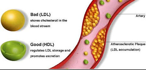 DR. ZEE-The Truth About Cholesterol – LDL Cholesterol & HDL Cholesterol