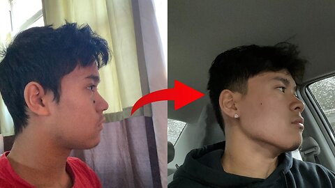 How To Get A Defined Jawline: Mewing Transformation