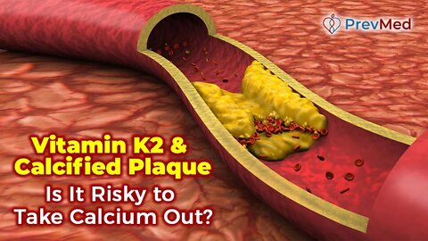 Vitamin K2 & Calcified Plaque - Is It Risky to Take Calcium Out?
