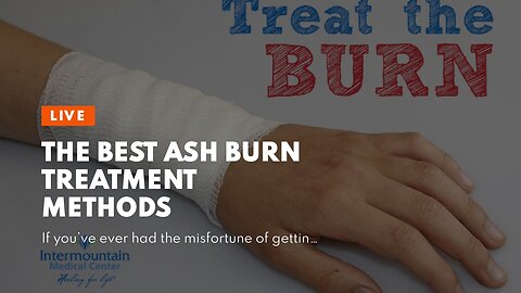 The Best Ash Burn Treatment Methods