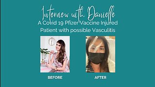 Interview with Danielle - A Covid 19 Pfizer Vaccine Injured Patient with possible Vasculitis