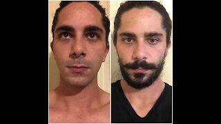 Beard Growth Time Lapse