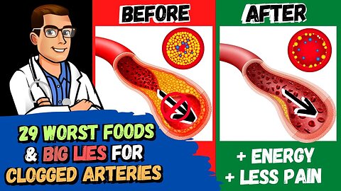 29 WORST Foods & Lies for Clogged Arteries [+2 SECRETS]